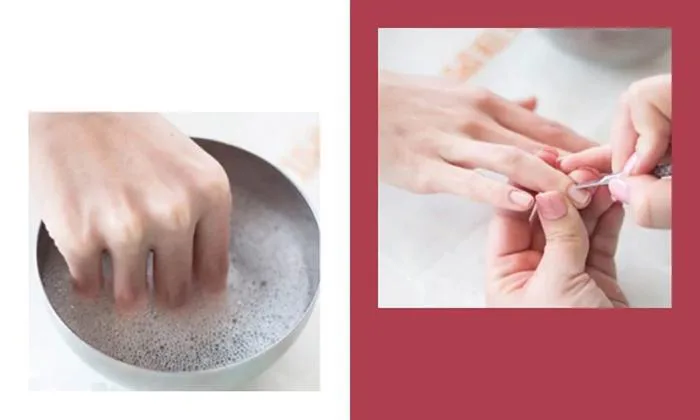 Cách tháo móng úp đơn giản, an toàn, đúng chuẩn tại nhà