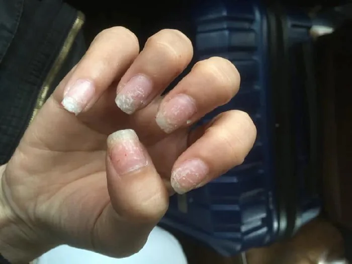 7 Cách dưỡng móng sau khi tháo gel đơn giản, hiệu quả