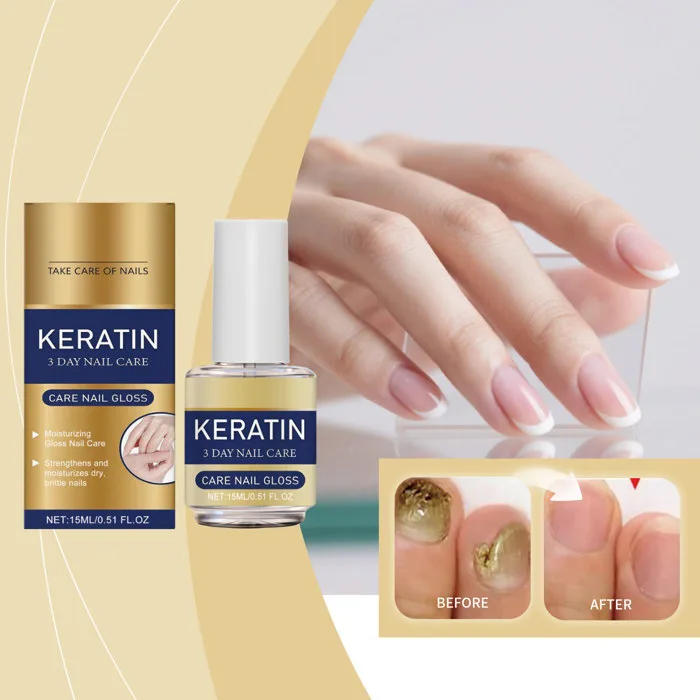 Dầu Dưỡng Móng Chuyên Nghiệp Panthenol & Keratin 15ml - Chiết Xuất Thực Vật  Chăm Sóc Dưỡng Móng Chắc Khỏe | Shopee Việt Nam