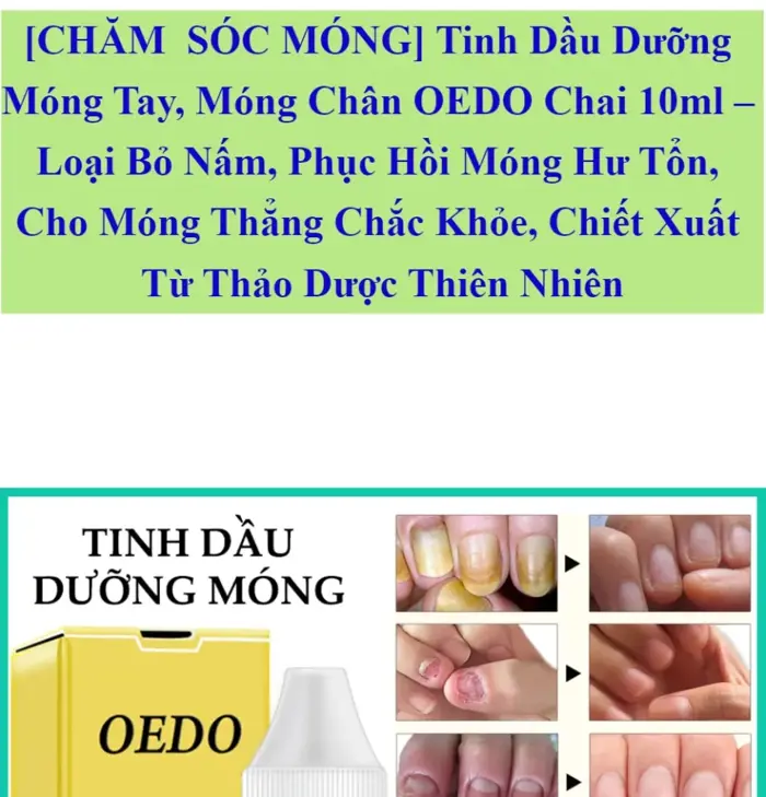 CHĂM SÓC MÓNG] Tinh Dầu Dưỡng Móng Tay Móng Chân OEDO Chai 10ml – Loại Bỏ  Nấm Phục Hồi Móng Hư Tổn Cho Móng Thẳng Chắc Khỏe Chiết Xuất Từ Thảo Dược