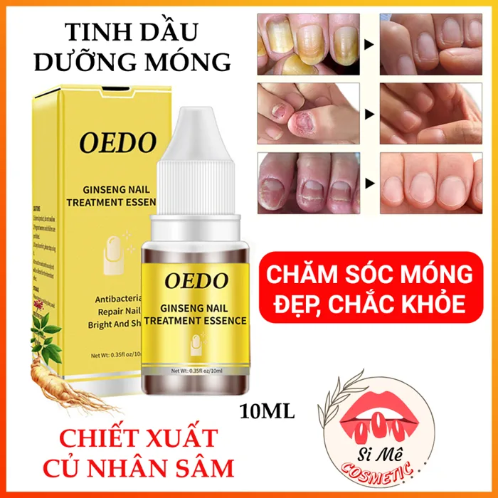 Tinh Dầu Dưỡng Móng Tay, Móng Chân OEDO Chiết Xuất Thảo Dược Chai 10ml –  Phục Hồi Móng Hư Tổn, Cho Móng Chắc Khỏe | Shopee Việt Nam