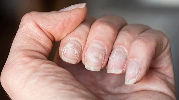 Hướng dẫn chi tiết: Chăm Sóc và Phục Hồi Móng Tay Sau Khi Tháo Móng Giả -  Lilian Beauty - Chuyên Phân Phối Sơn Móng Tay, Phụ kiện Nail