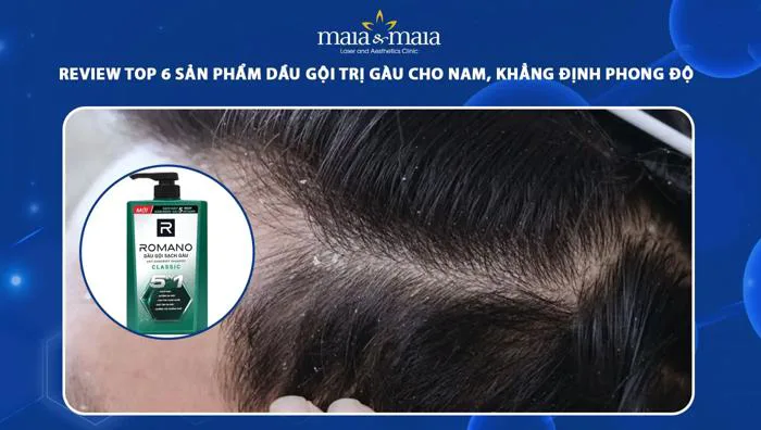 Review TOP 6 sản phẩm dầu gội trị gàu cho nam, phong độ cao