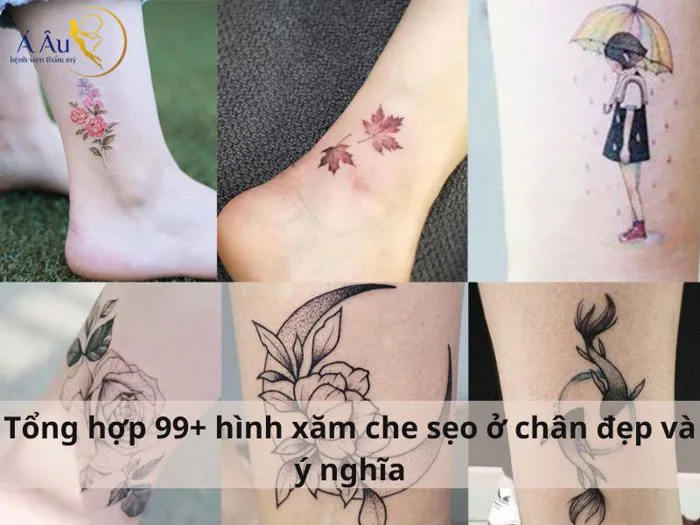 Tổng hợp 99+ hình xăm che sẹo ở chân đẹp và ý nghĩa - Bệnh viện thẩm mỹ Á Âu