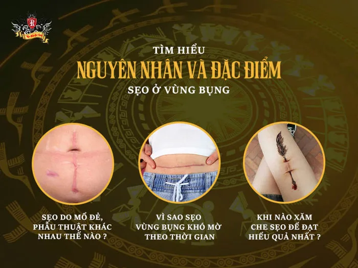 Hình Xăm Che Sẹo Ở Bụng Cho Nữ: Tái Tạo Vẻ Đẹp Đầy Tự Tin