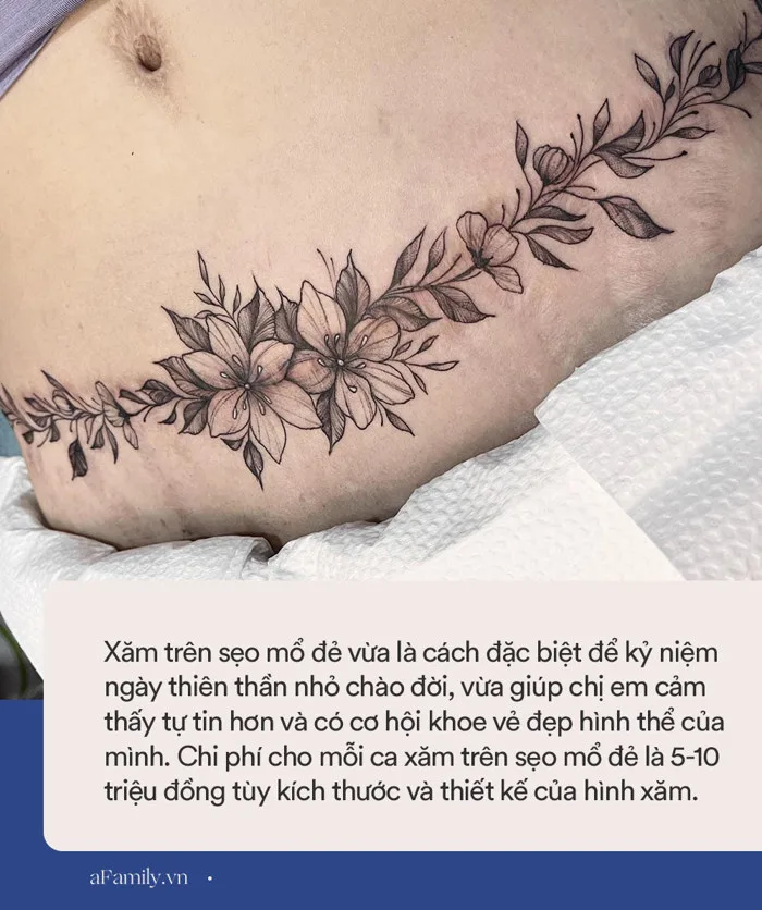 Người biến vết sẹo mổ đẻ, bụng rạn tung tóe của chị em sau sinh thành tác  phẩm nghệ thuật