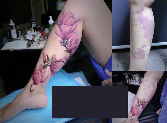 Chuyện về cô thợ xăm trồng hoa trên những vùng da sẹo, xóa tự ti cho chị em  sau sinh