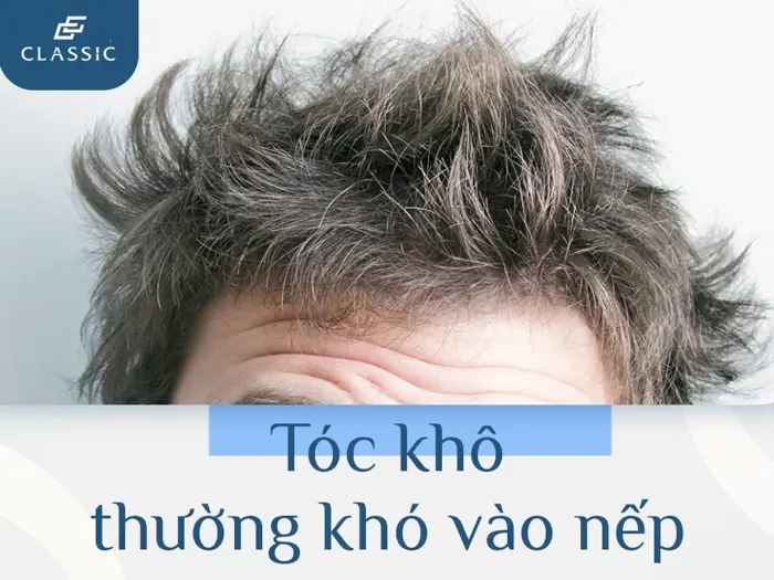Cách khắc phục tóc xoăn cho nam giới để tạo kiểu dễ dàng hơn