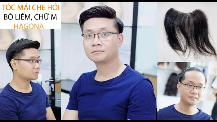 Cách dán keo và gội tóc giả mái che hói chữ M cho nam