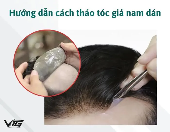 Hướng Dẫn Tháo Tóc Giả Dạng Dán Đơn Giản, Nhẹ Nhàng | VTG Hair