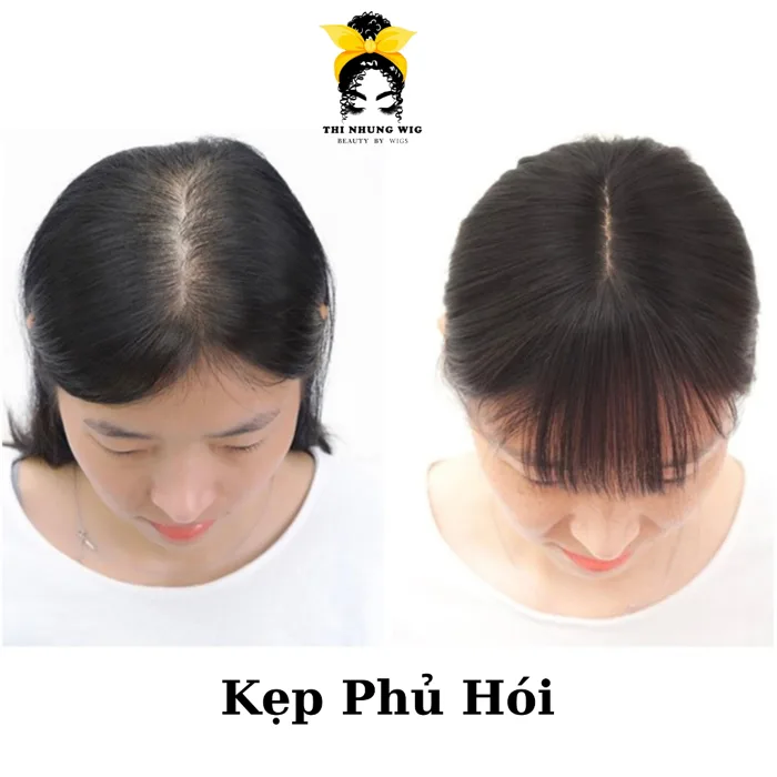 Kẹp Phủ Hói Tóc Thật, Tóc Giả THINHUNGWIG Tóc Mái Che Hói Bằng Tóc Thật Cao  Cấp Kẹp Mái Hói Tóc Thật Hai Mái Có Mái Thưa | Shopee Việt Nam