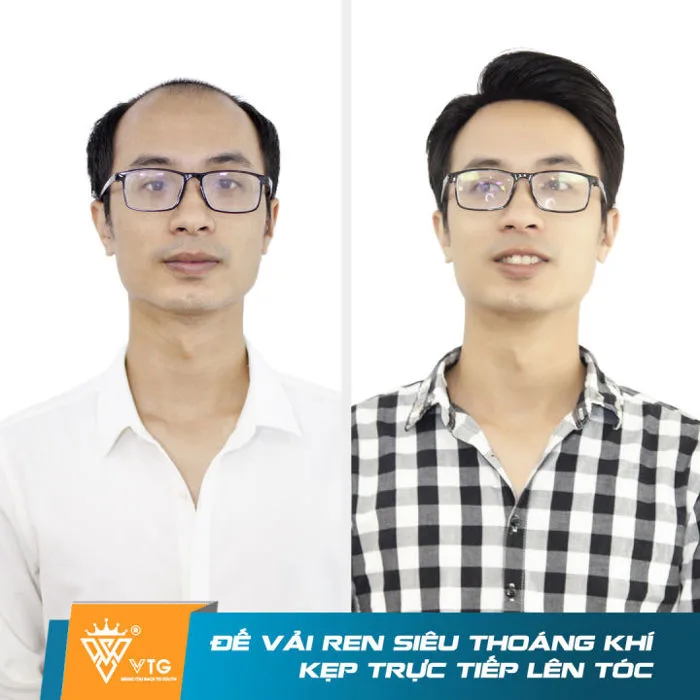 Tóc giả nam mái hói màng đôi dạng kẹp VTG D16 làm từ sợi tóc thật 100% che  hói hiệu quả - Vua Tóc Giả - Tóc Giả Nam | Lazada Việt Nam