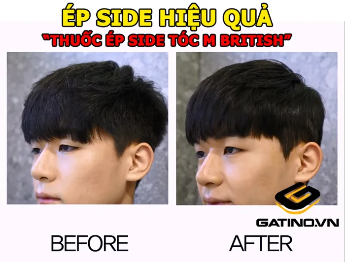 Ép side tóc nam giá bao nhiêu? Thuốc ép side tóc nam tại nhà tiện lợi