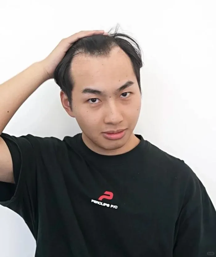 7 Kiểu Tóc Ngắn Cho Nam Trán Cao Cứ Cắt Là Đẹp Trai